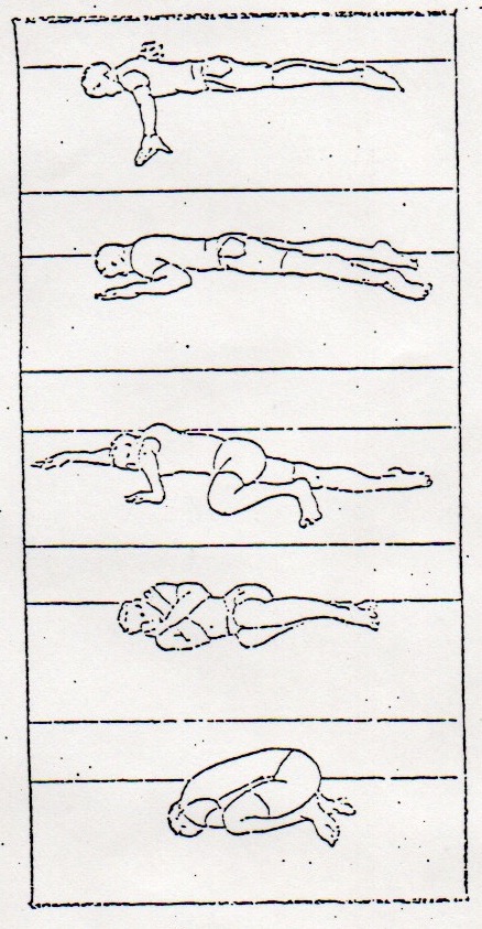 Dart-Murray Procedures floor illustrations