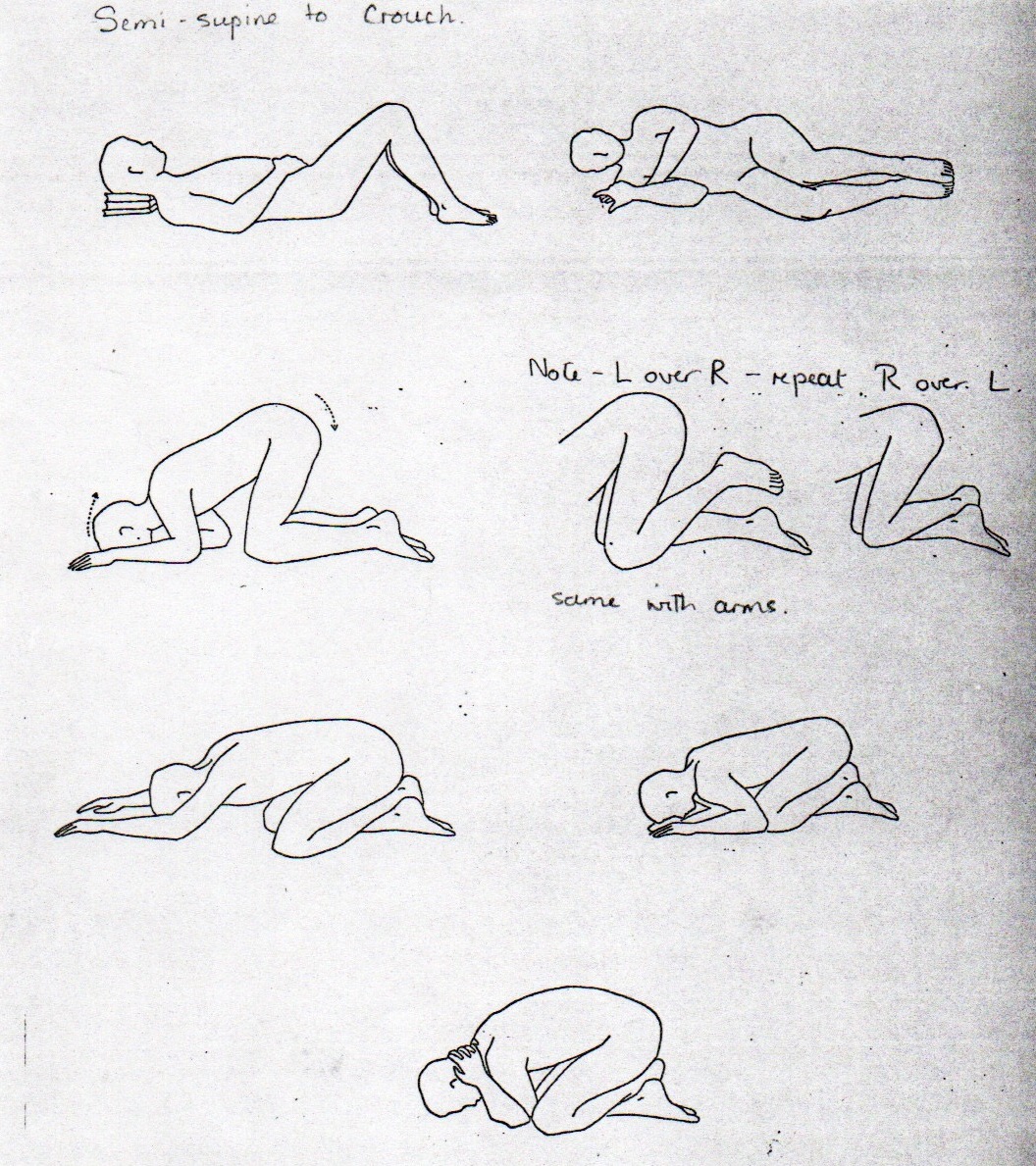 Dart-Murray Procedures illustrations 1970s