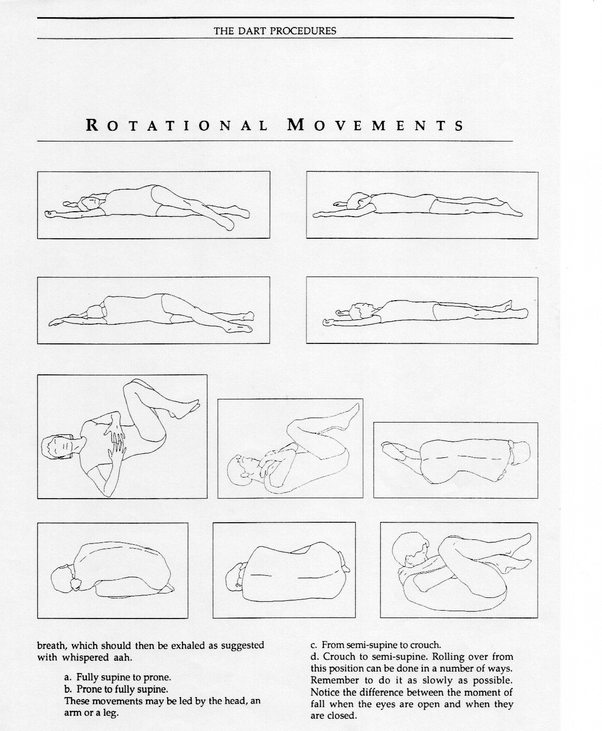 Pictures of Dart Procedures early 1980s