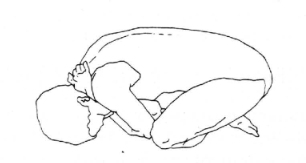 fetal position of mechanical advantage